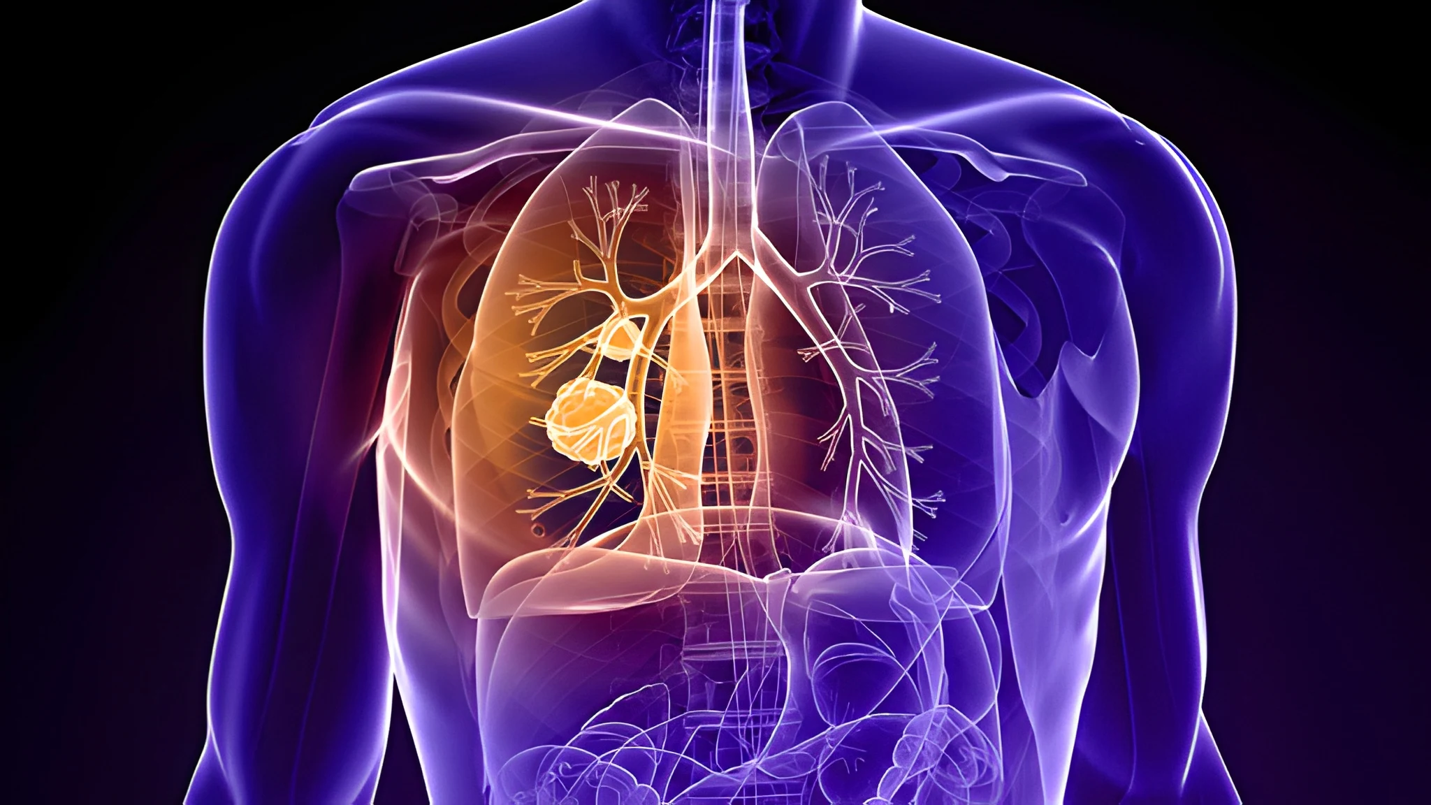 lung-cancer-drug-meets-trial-goal