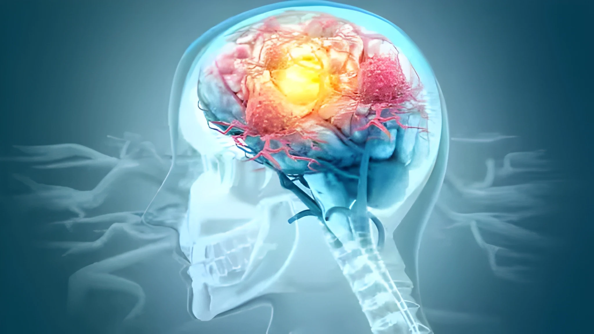 new-study-offers-hope-for-sleep-in-alzheimers