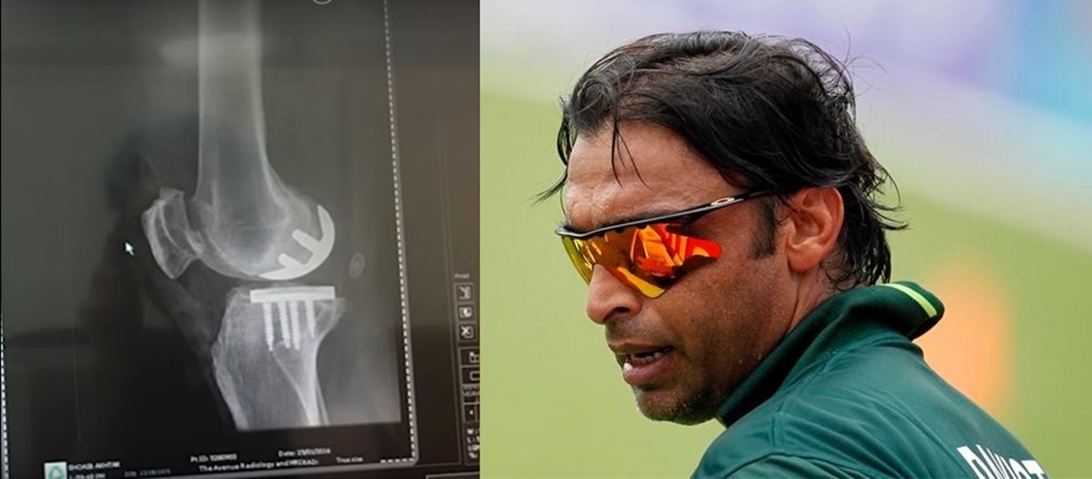 shoaib-akhtar-to-undergo-total-knee-replacement-surgery